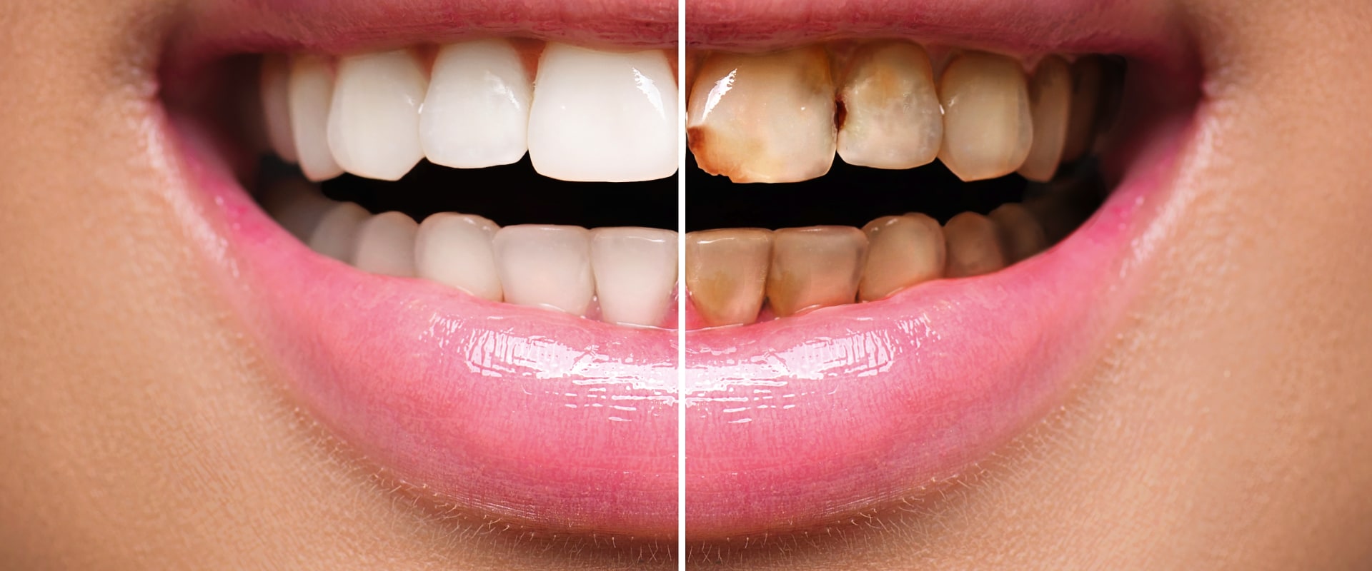 What is the Difference Between Preventive and Restorative Dental