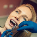 How Long Does Dental Anesthesia Last?