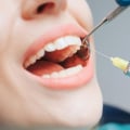 What are the Side Effects of Dental Injections?