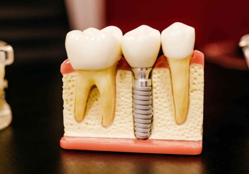 What are the Side Effects of Dental Treatments?
