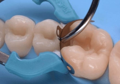 Types of Dental Products and Examples