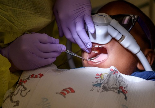 What Dental Procedure Takes 4 Hours?