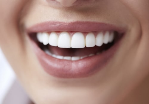 How Long Do Dental Treatments Last?