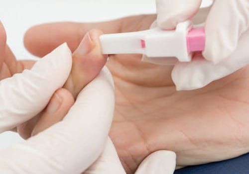 Dental Care for People Living with HIV/AIDS: Special Considerations