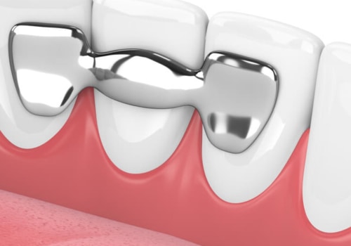 Alternative Dental Treatments: Exploring Holistic and Cosmetic Solutions